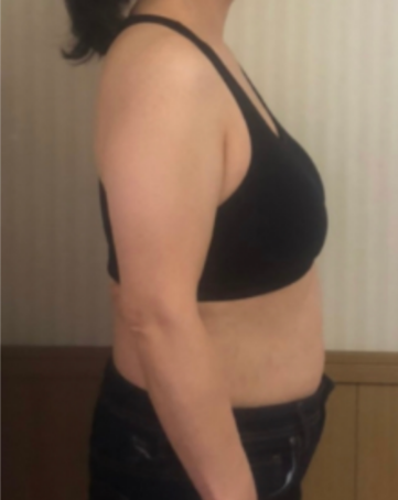 BEFORE画像1