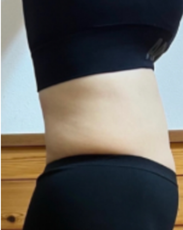 BEFORE画像3