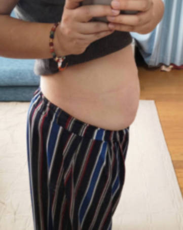 BEFORE画像5