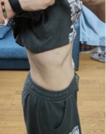 AFTER画像5