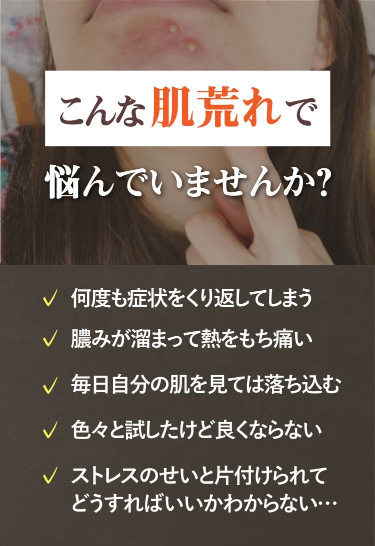 こんな肌荒れで悩んでいませんか？何度もニキビをくり返す、患部に膿が溜まって熱をもち痛い、ニキビがすぐにできやすい、自分の肌を見るたび落ち込む、サプリ、スキンケア、色々と試したけど良くならない、ストレスのせいと片付けられる、どうすればいいかわからない