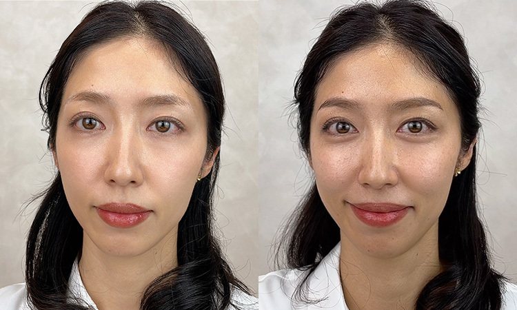 使用前後の画像