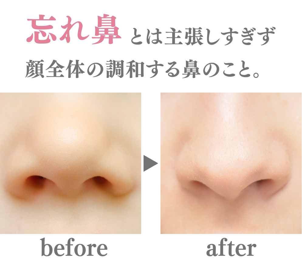 背景画像の上にのせる画像1