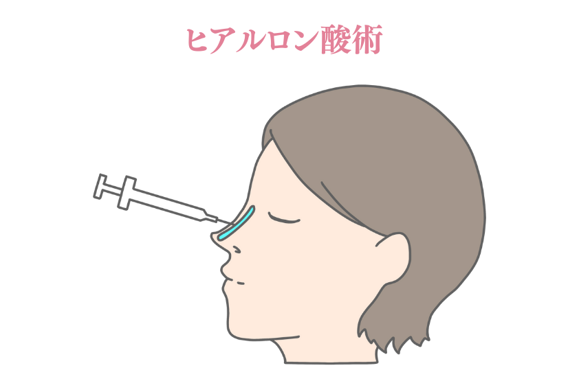 背景画像の上にのせる画像1