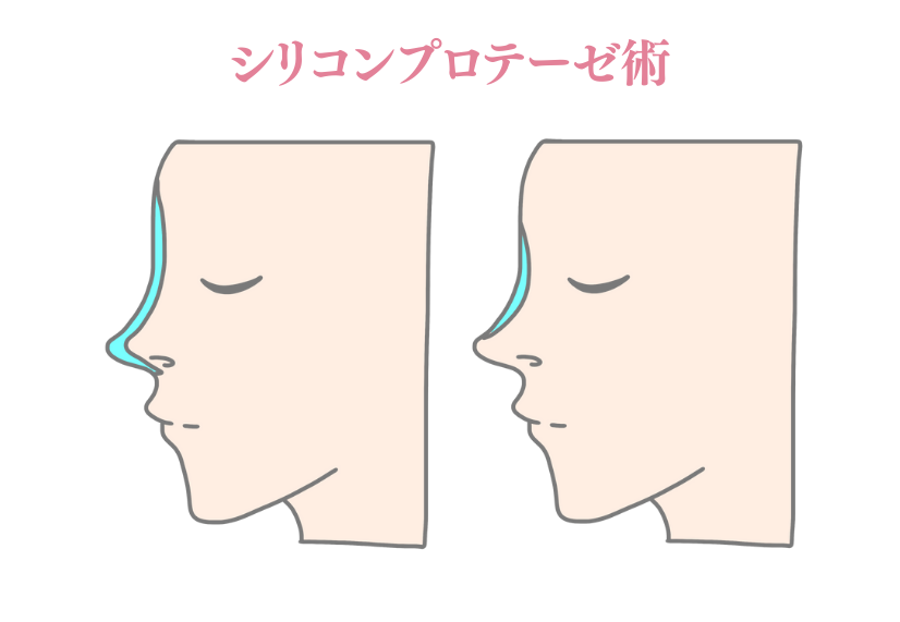 背景画像の上にのせる画像1