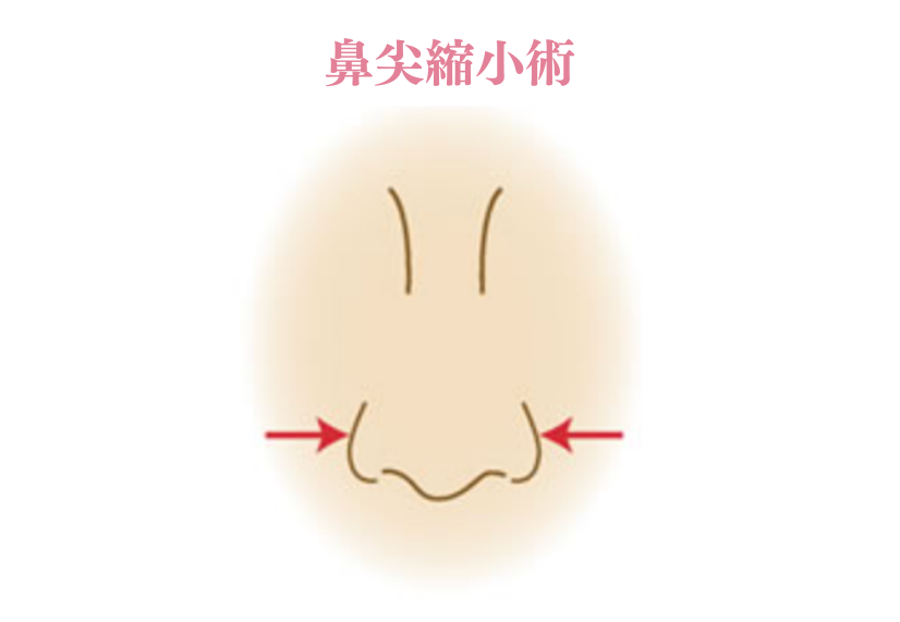 背景画像の上にのせる画像1