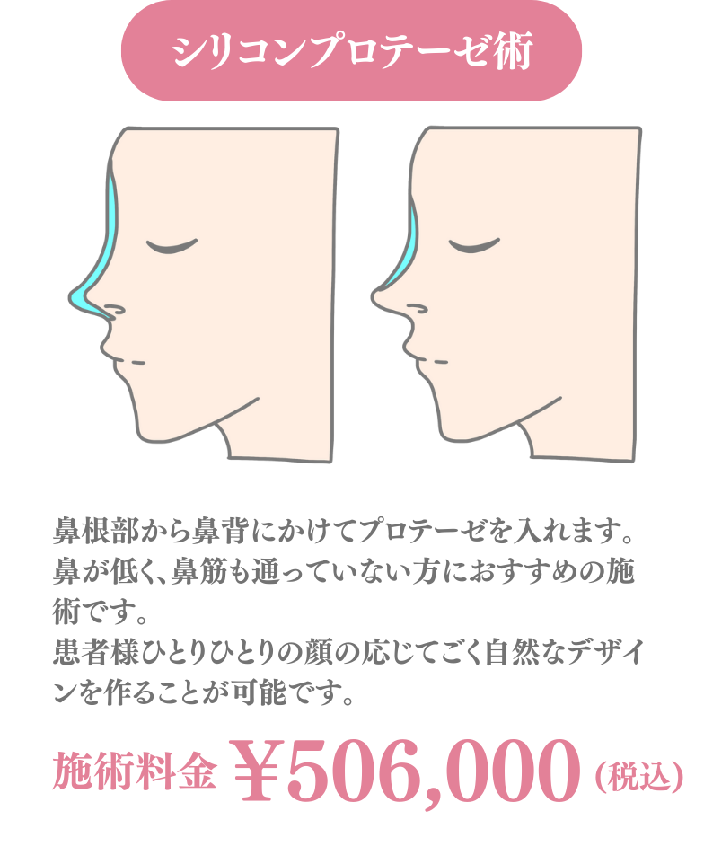 背景画像の上にのせる画像1