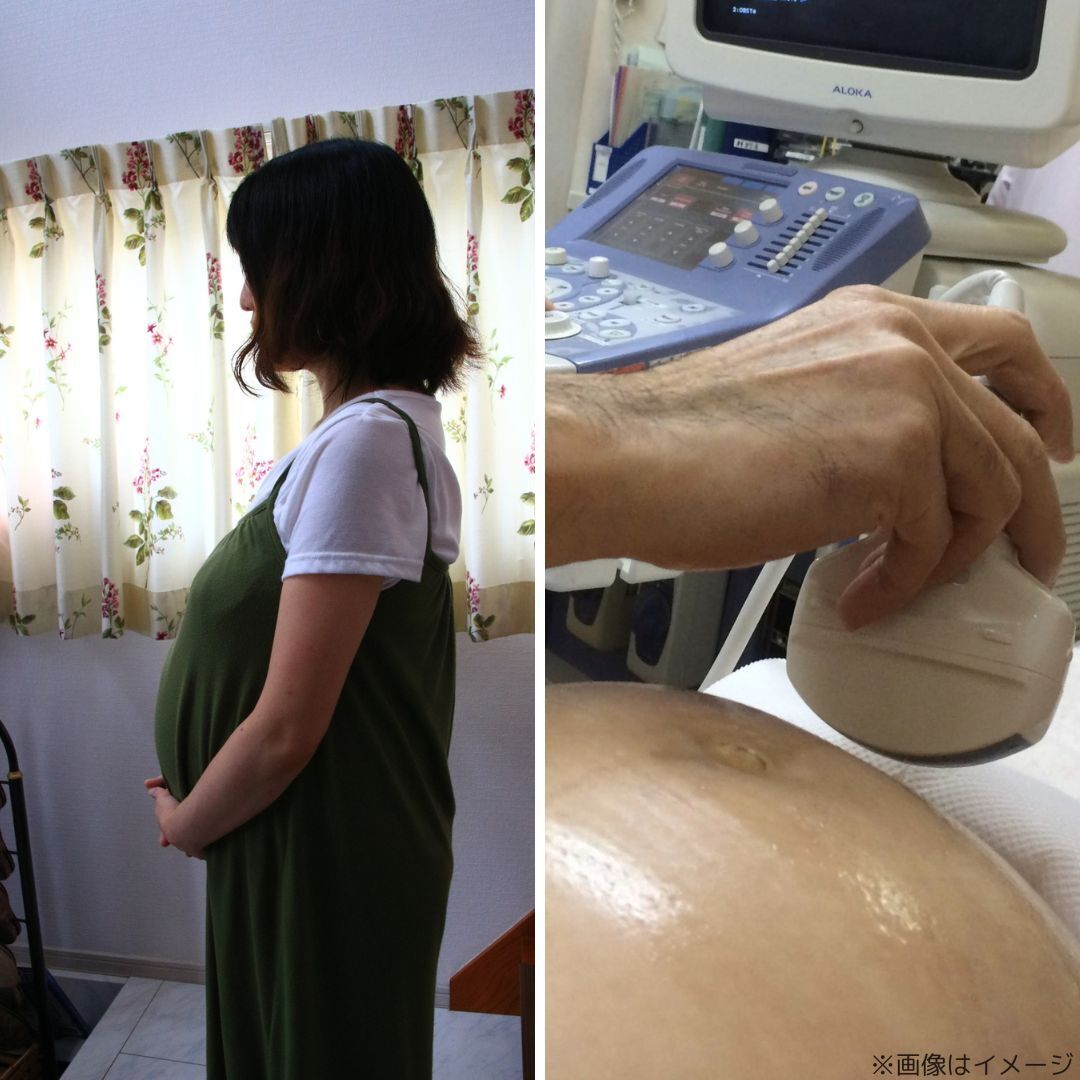 赤ちゃんと母親