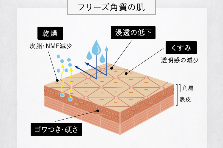POINT エイジングくすみ※1の原因「フリーズ角質とは？」 加齢や摩擦によって角質の骨組み「骨格タンパク」が増えすぎて、角層が固くなった状態のこと。 肌の乾燥 浸透の低下 くすみ などの原因になります。 だから、毎日のケアで柔らかくすることが大切です。