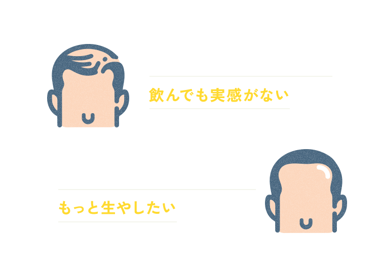 AGA薬（フィナステリド）を飲んでも実感がない せっかくAGA治療をするならもっと生やしたい