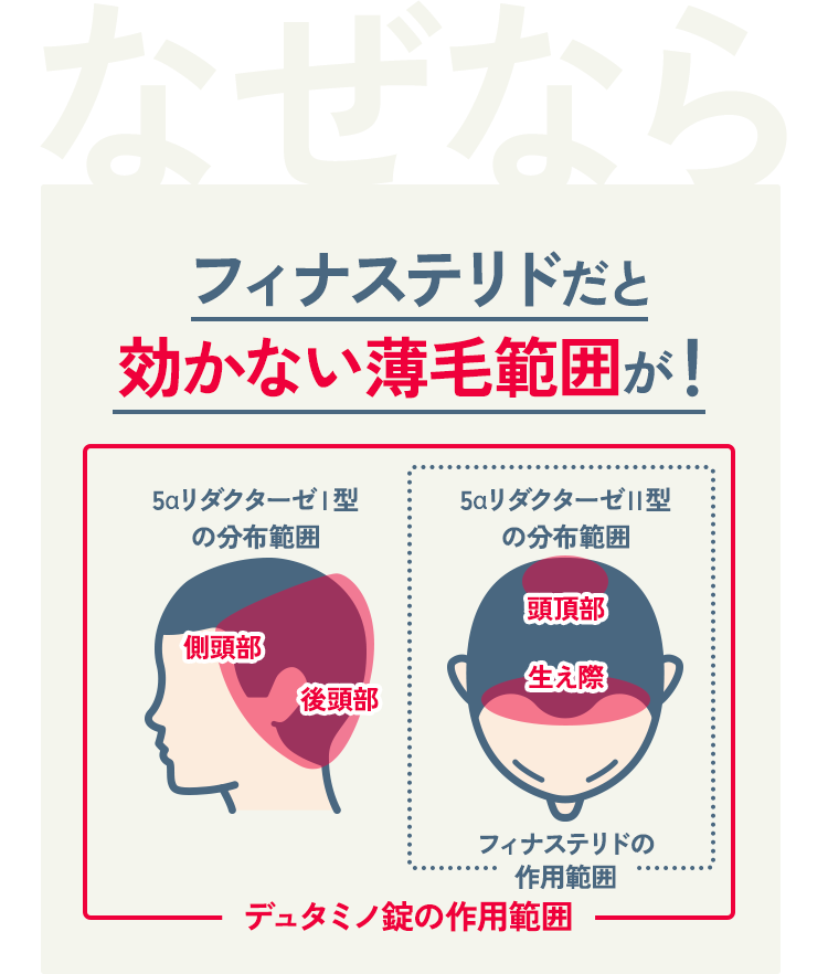 なぜならフィナステリドだと効かない薄毛範囲が！5αリダクターゼⅠ型の分布範囲 側頭部 後頭部 5αリダクターゼⅡ型の分布範囲 頭頂部 生え際 フィナステリドの作用範囲 デュタミノ錠の作用範囲