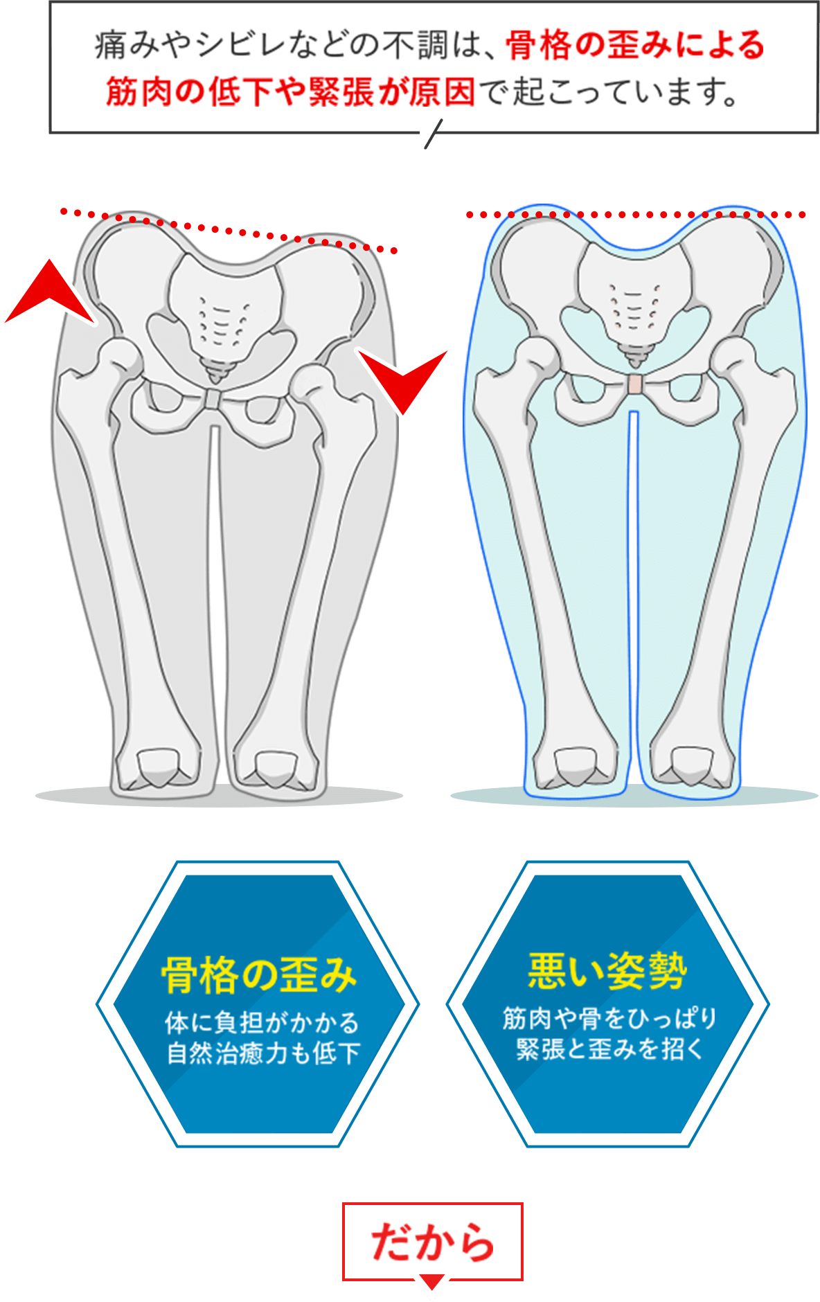 骨盤のイラスト