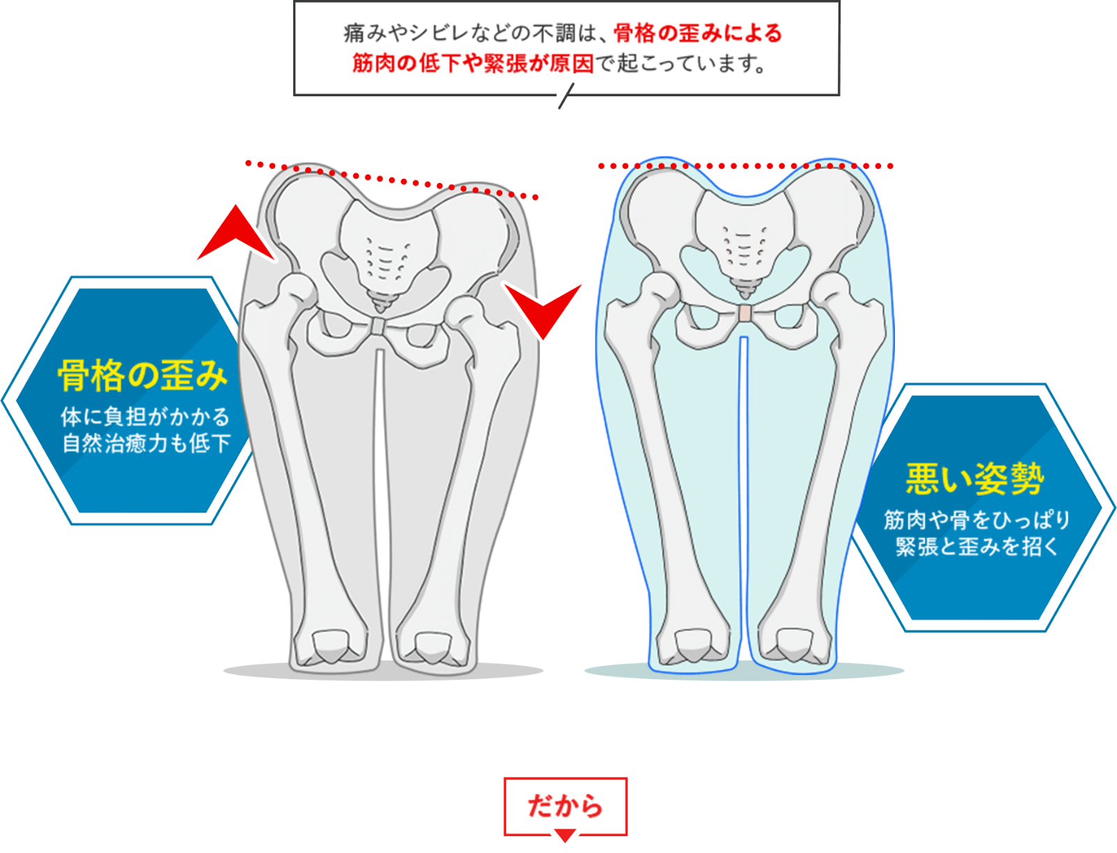 骨盤のイラスト