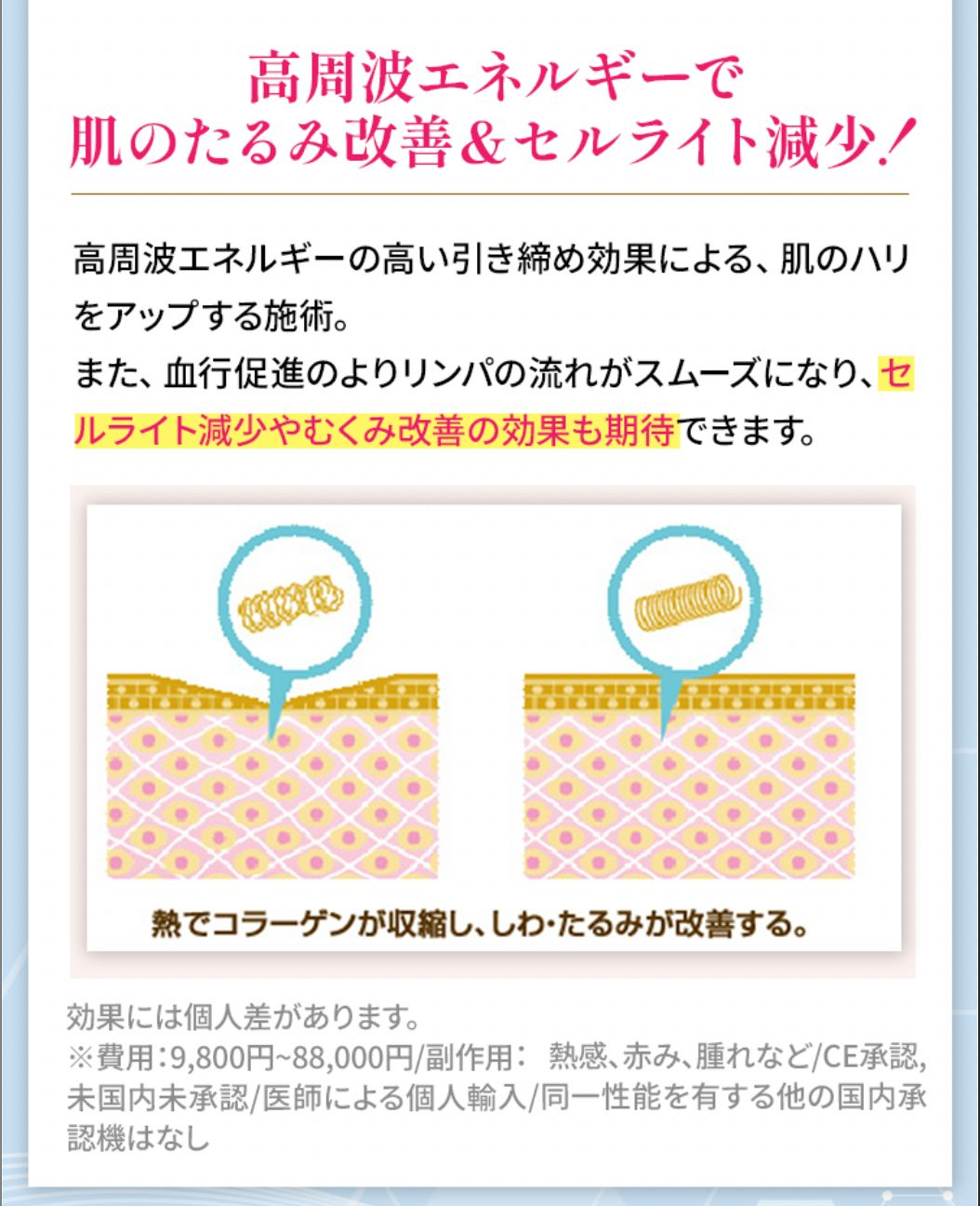 医療ラジオ波＜顔・ボディ＞