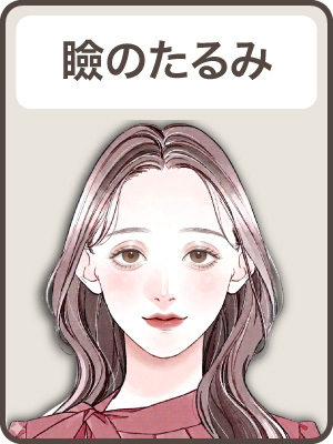 【まぶたのたるみ BA Before】