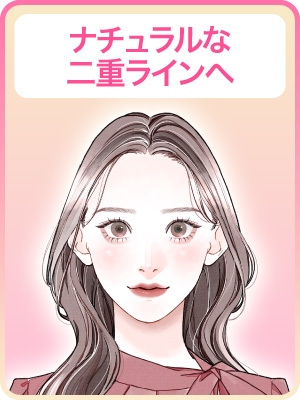 【二重ライン消失 BA After】