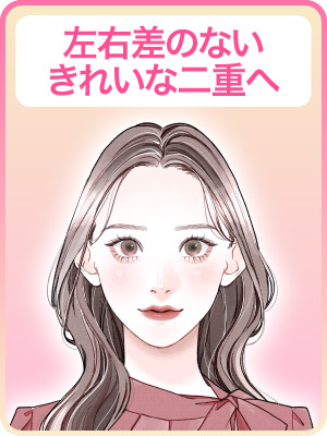 【目の左右差 BA After】