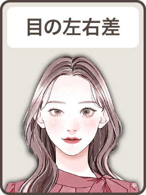 【目の左右差 BA Before】