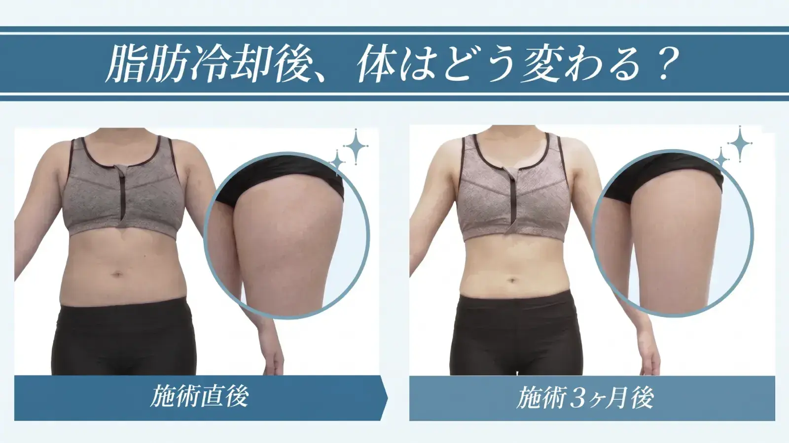 ビフォーアフター＋年齢層・性別データ