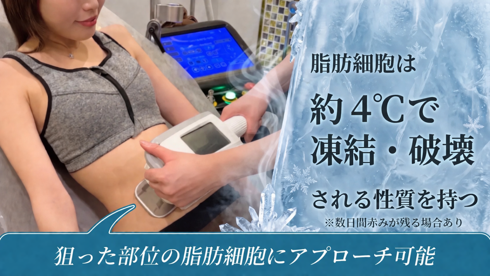 脂肪冷却施術イメージ