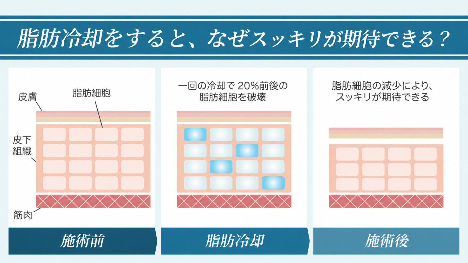 ダイエット比較図（下）
