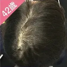 CASE 1 Before症例写真
