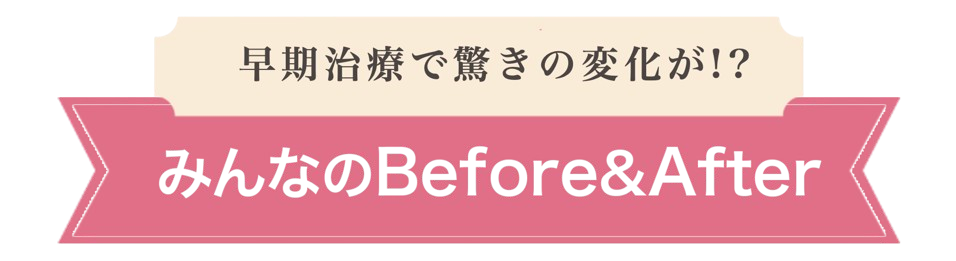 最短3ヶ月で驚きの変化！ みんなの Before & After