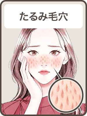 【たるみ毛穴 BA Before】