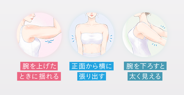 二の腕の悩み：腕を上げたときに揺れる・正面から横に張り出す・腕を下ろすと太く見える