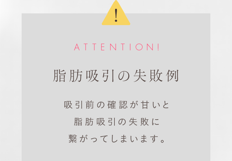 ATTENTION! 脂肪吸引の失敗例