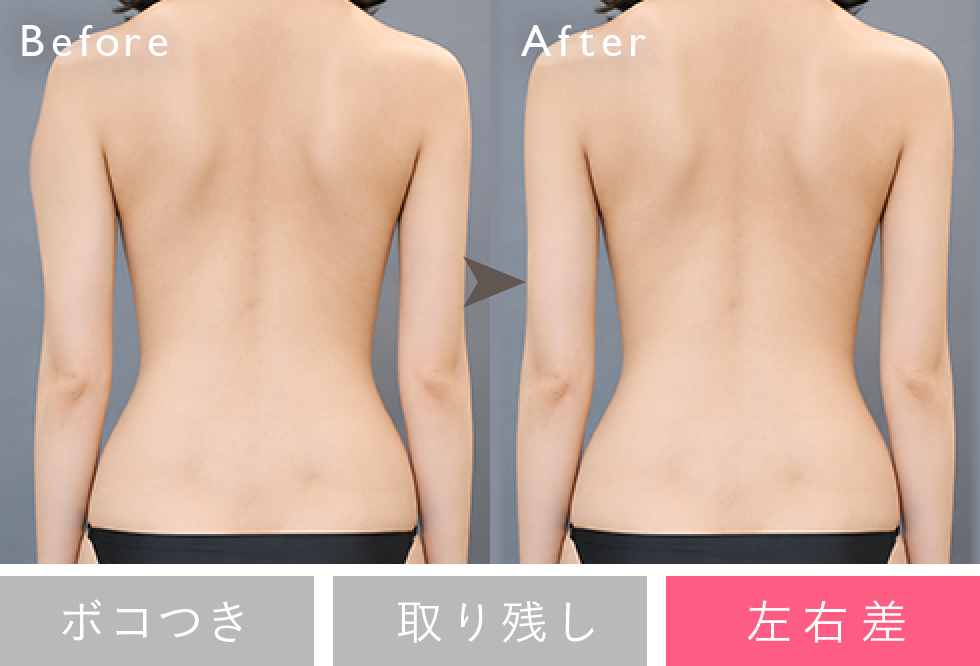 失敗修正例：左右差 Before/After