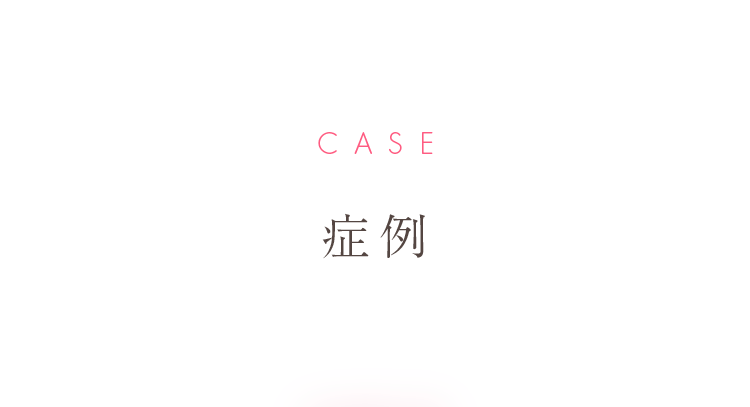 CASE 症例