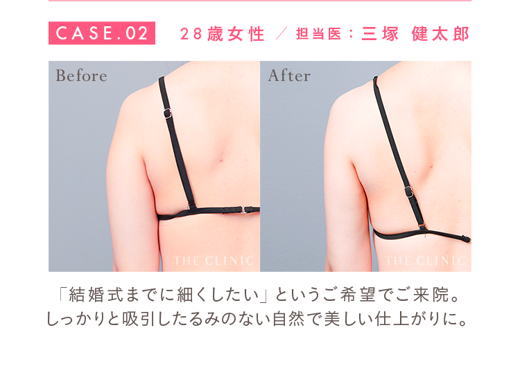 CASE.02 28歳女性 担当医：三塚 健太郎 Before/After