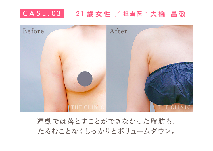 CASE.03 21歳女性 担当医：大橋 昌敬 Before/After