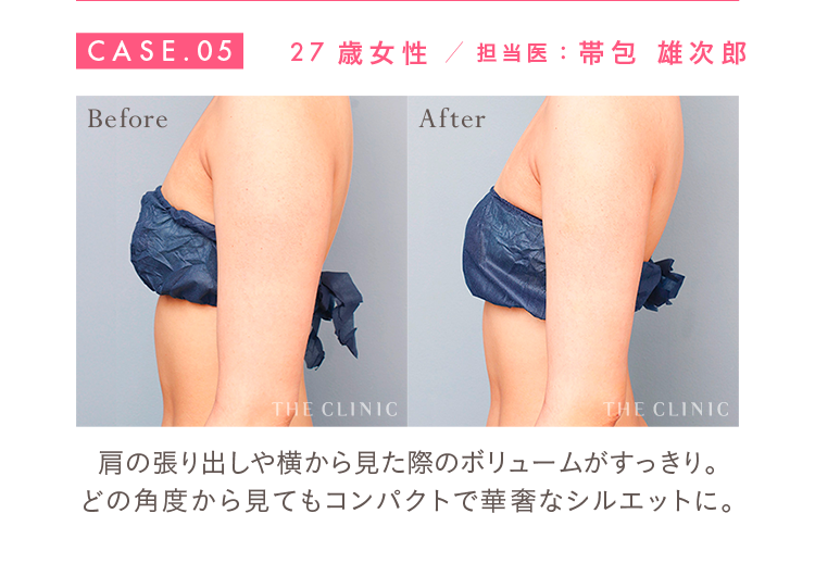 CASE.05 27歳女性 担当医：帯包 雄次郎 Before/After