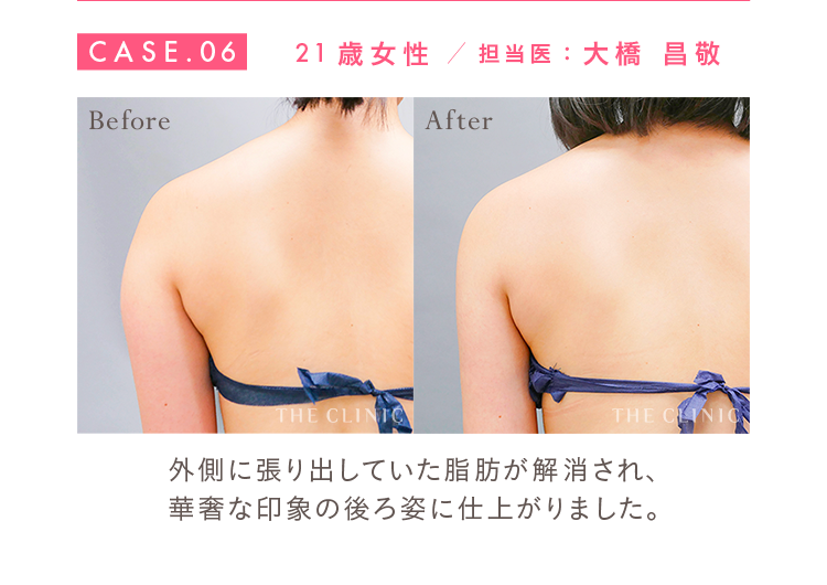 CASE.06 21歳女性 担当医：大橋 昌敬 Before/After