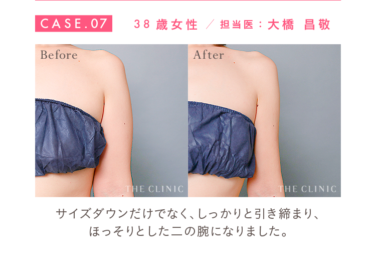 CASE.07 38歳女性 担当医：大橋 昌敬 Before/After