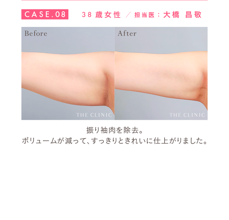 CASE.08 38歳女性 担当医：大橋 昌敬 Before/After