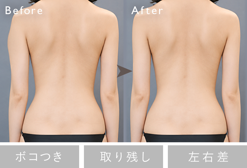 失敗修正例：左右差 Before/After