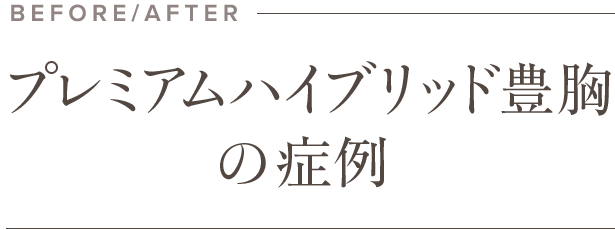プレミアムハイブリッド豊胸の症例