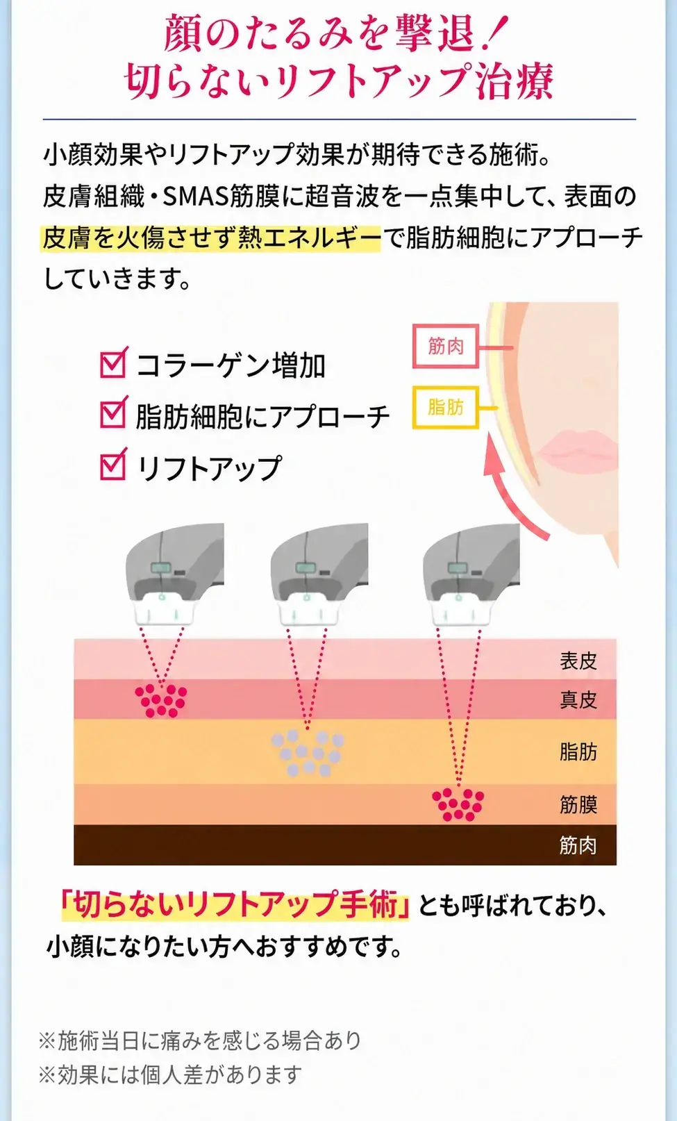 医療フェイスハイフ