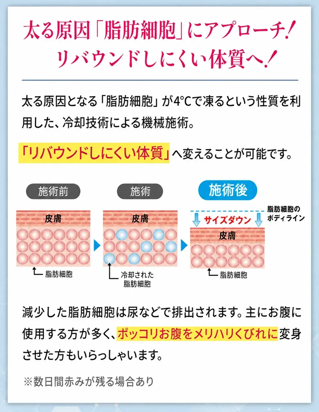 脂肪冷却装置