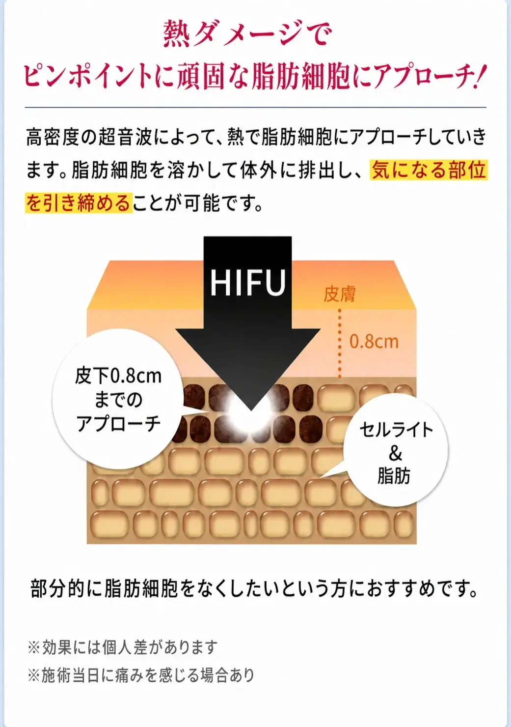 医療ボディハイフ
